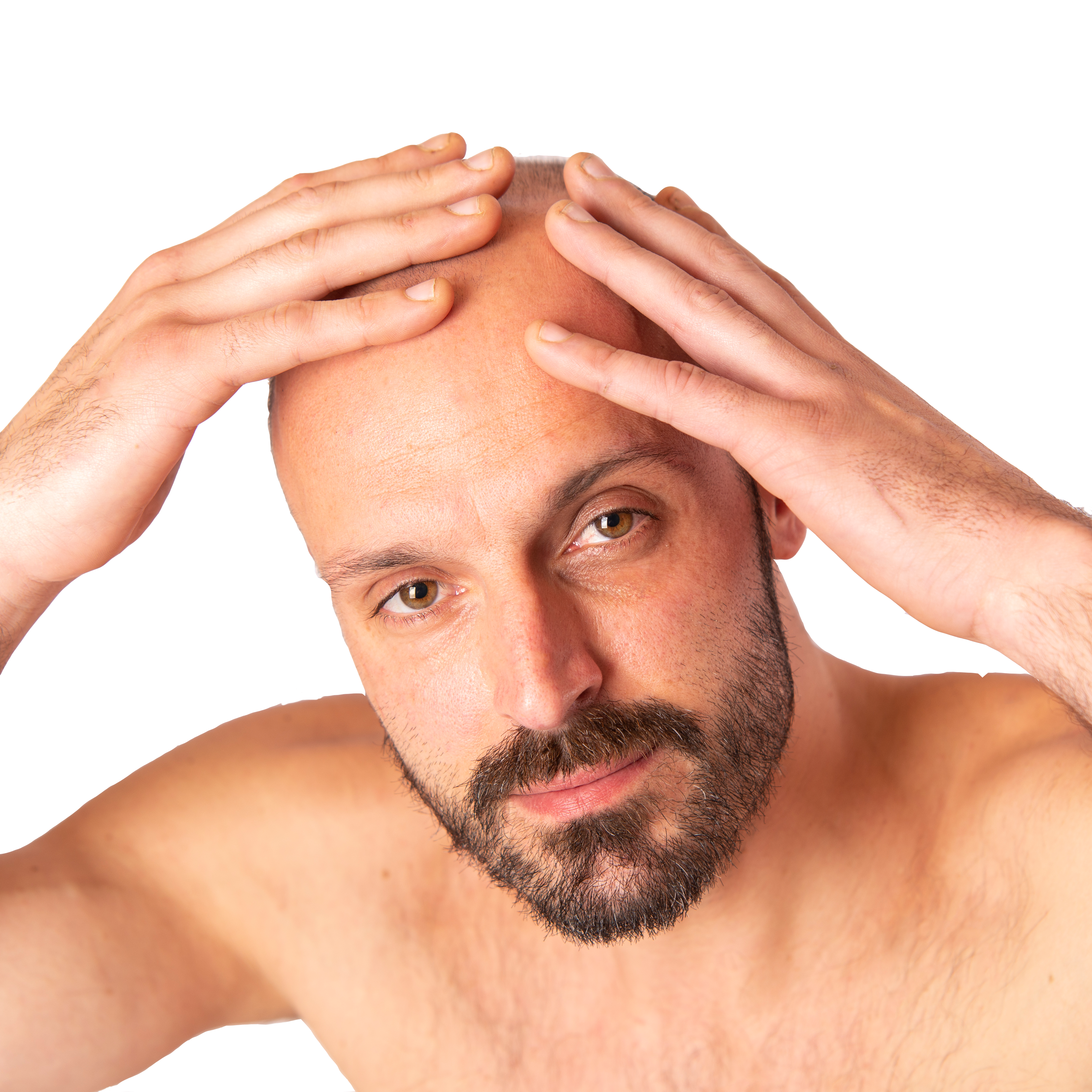 Haartransplantation