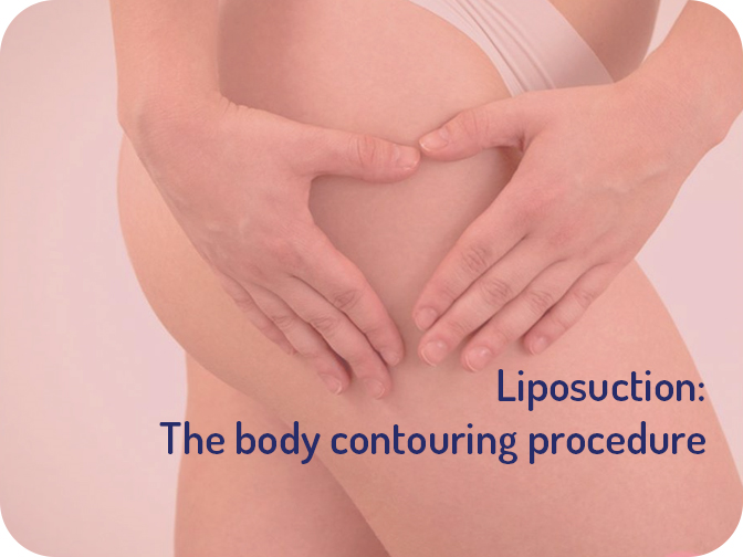 Facts and Myths about Liposuction