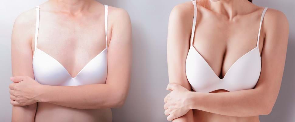 What does breast enlargement with your own fat involve?