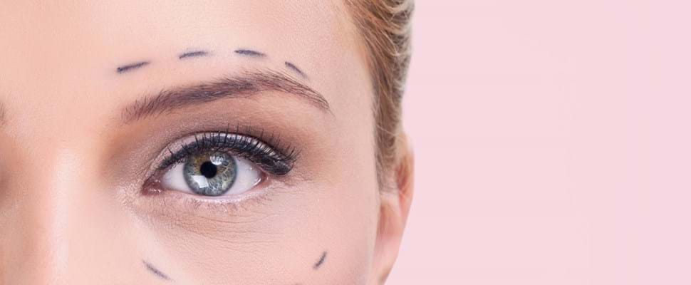 What to expect after eyelid surgery?