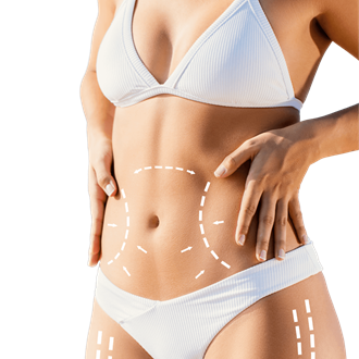 Liposuction