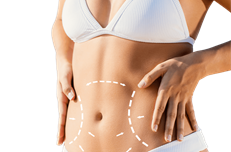 Liposuction