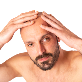 Hair Transplantation Photos: Hair Transplantation