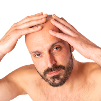 Hair Transplantation Before and After Photos: Hair Transplantation