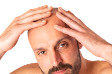 Transplantation capillaire