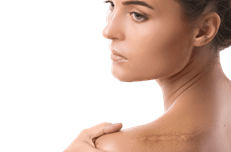 Correction des cicatrices