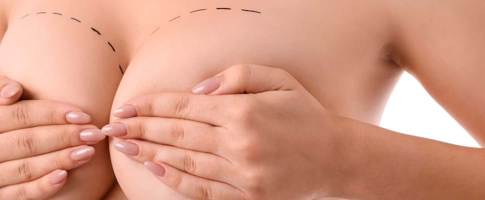 Verslagen Graden Celsius Zijdelings Hoe lang gaan borstimplantaten mee? | Wellness Kliniek