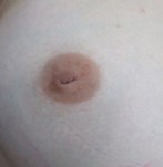 Vorher