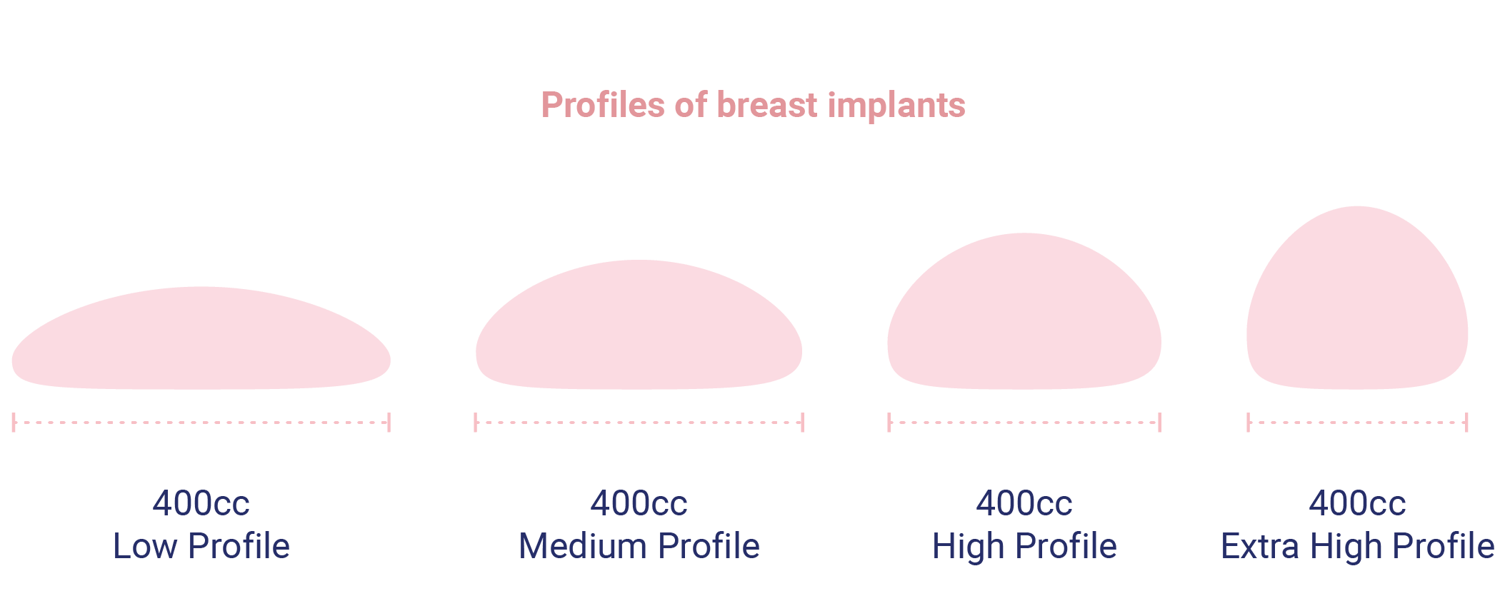 Die verschiedene Profile der Brustimplantaten