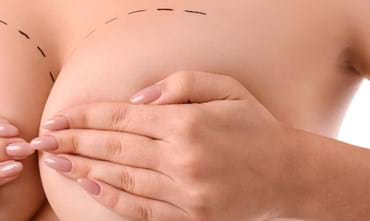 When should breast implants be replaced?