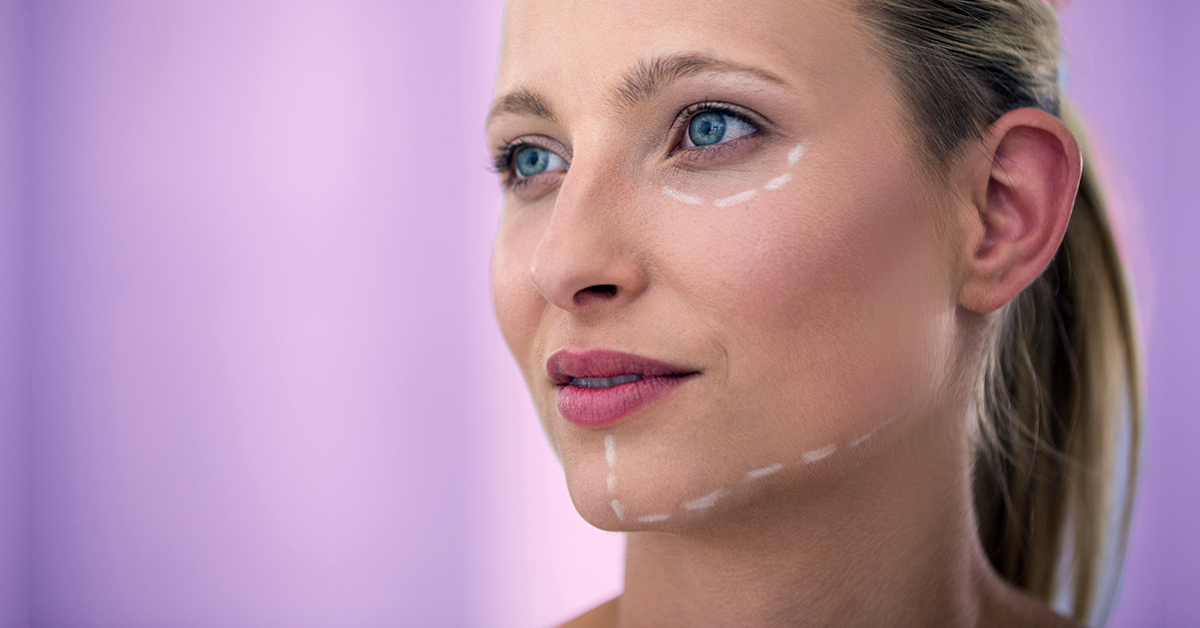 Plastische Gesichtschirurgie ist kein Tabu mehr