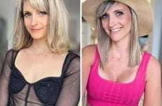 Photos avant/après d'une augmentation mammaire