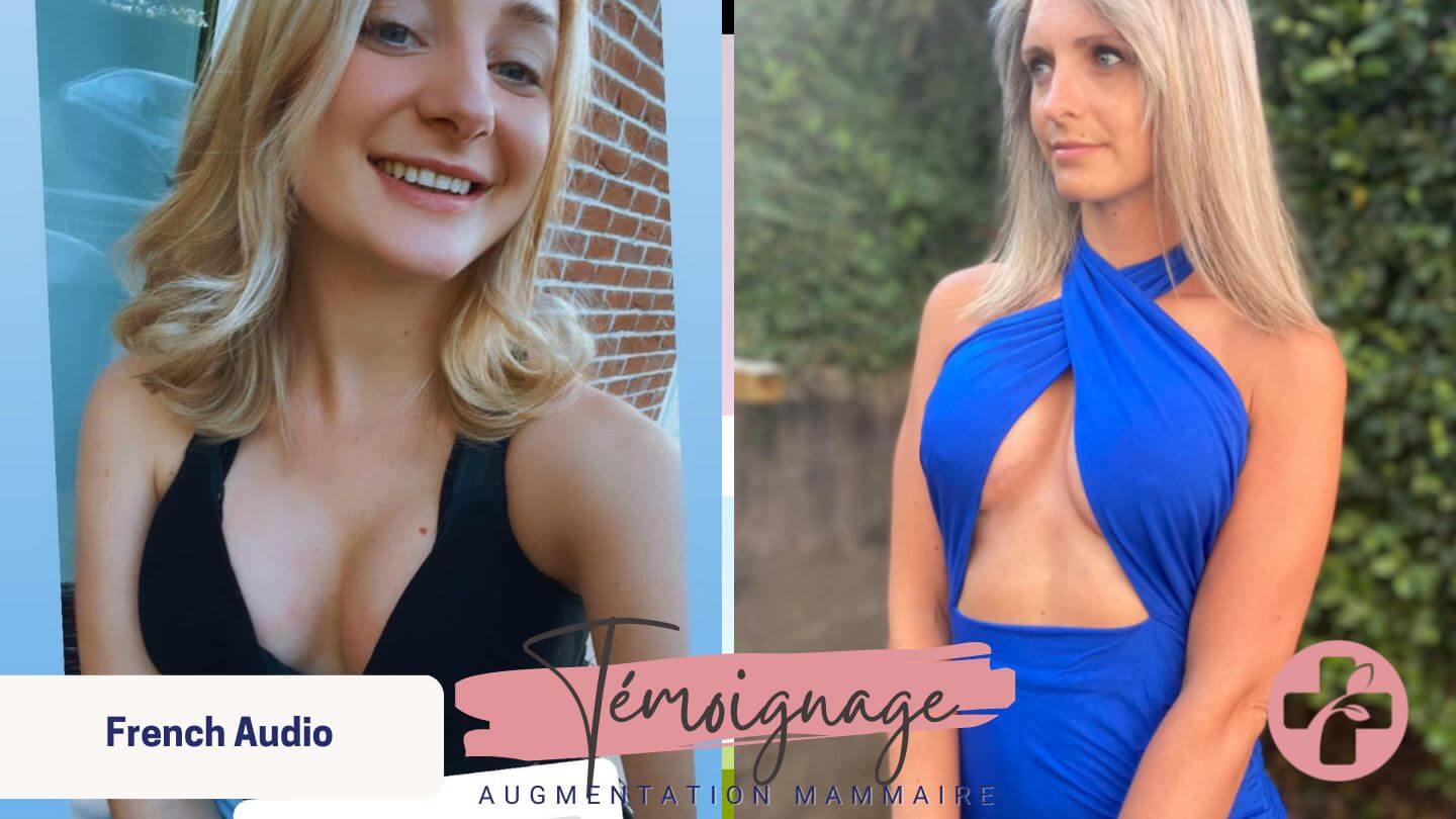 D'autres patients nous ont déjà fait part de leurs témoignages