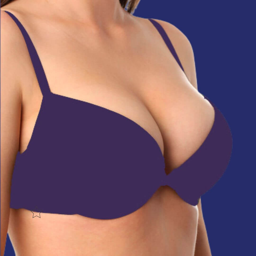 photos de résultats d'implants mammaires de taille 300cc