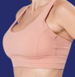After Cup B to Cup C with breast lipofilling