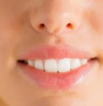 Frontal image of the face after lip lift surgery, with a radiant smile