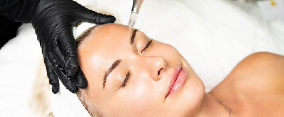Microneedling