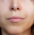 Gros plan des lèvres avant Augmentation des levres avec produits de remplissage - fillers