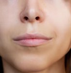 Close-up of lips before lipfiller