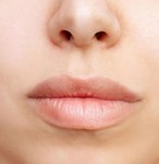 Image frontale du visage après Augmentation des levres avec fillers