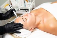 Microneedling