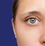 Photograph of blepharoplasty results